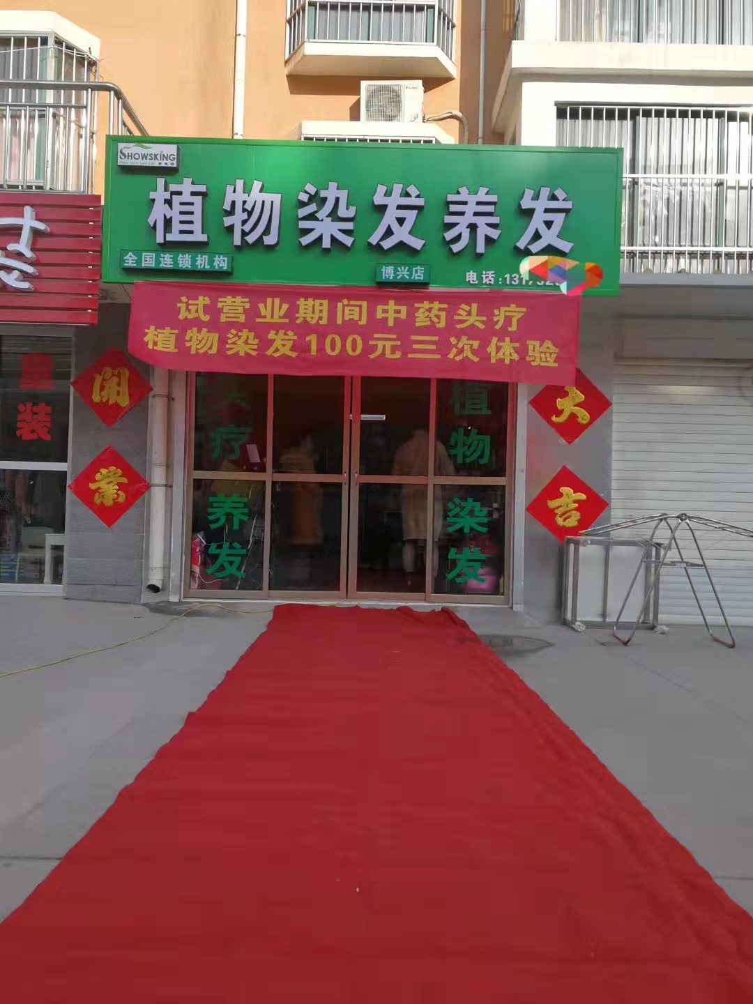 斑秃一次治愈