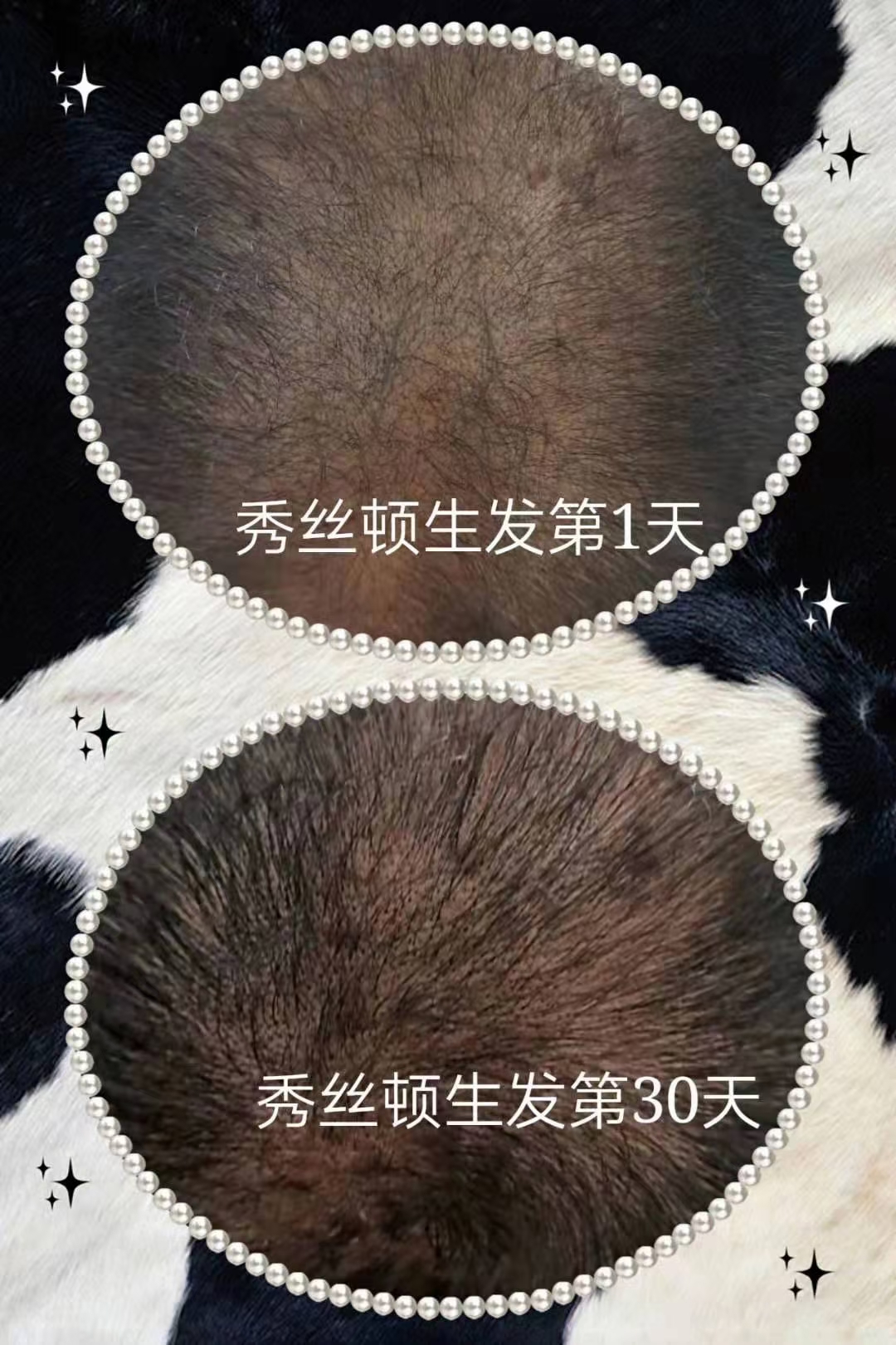 秀丝顿植物养发够滋养头皮，刺激毛囊，增加发丝的养分供应，从而达到改善白发、防止脱发