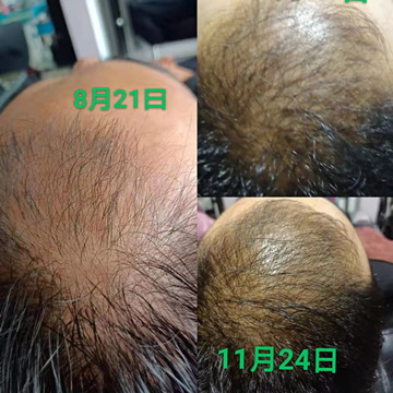 秀丝顿植物养发的产品可以滋润你的头发，从根部开始，让白发自然变黑