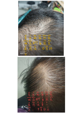 秀丝顿植物养发是一种非常出色的养发产品。它能够有效地解决你的白发问题