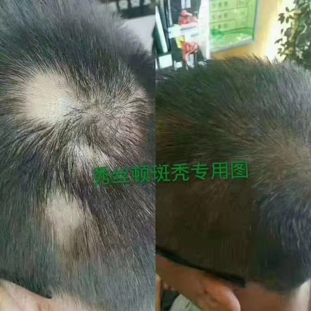 秀丝顿植物养发是一种纯天然的头发养护产品