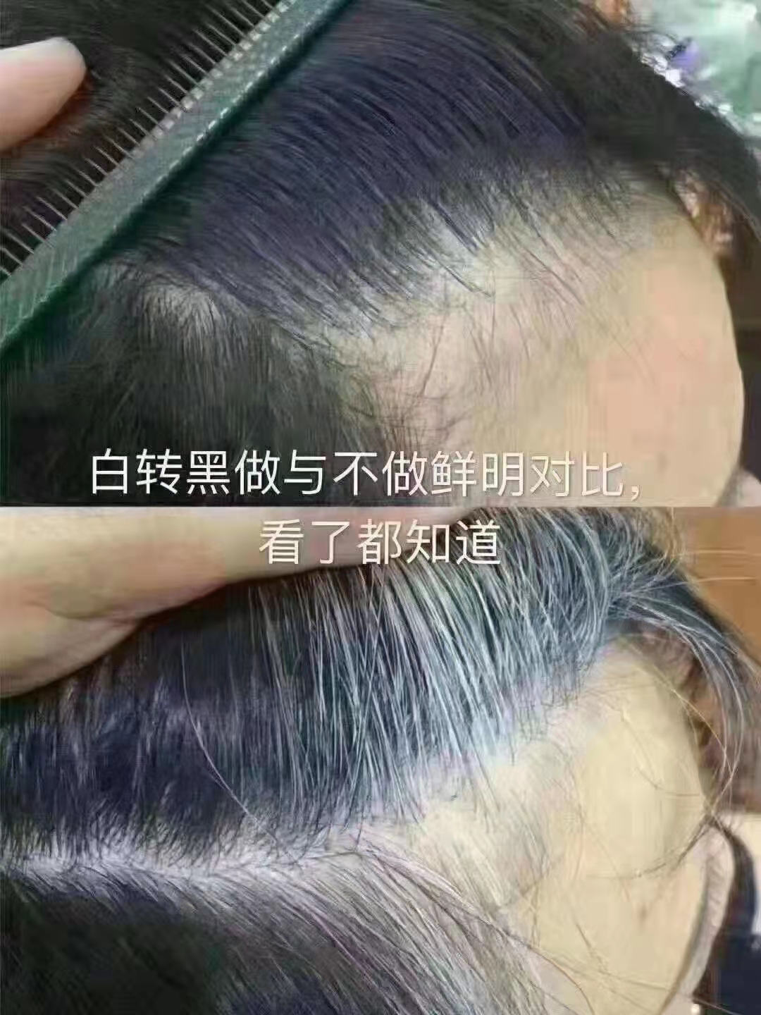 秀丝顿植物养发是一家专注于头发护理的品牌，其防脱发产品备受好评