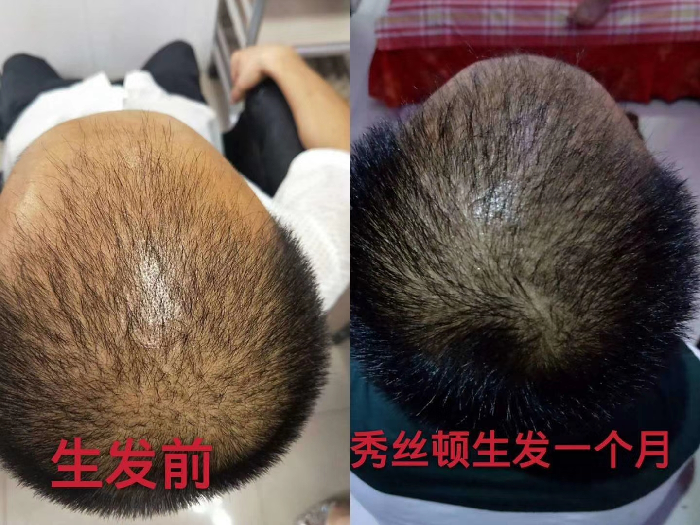 秀丝顿植物染发是一种全新的染发方式，它采用天然植物成分，不含任何化学染料
