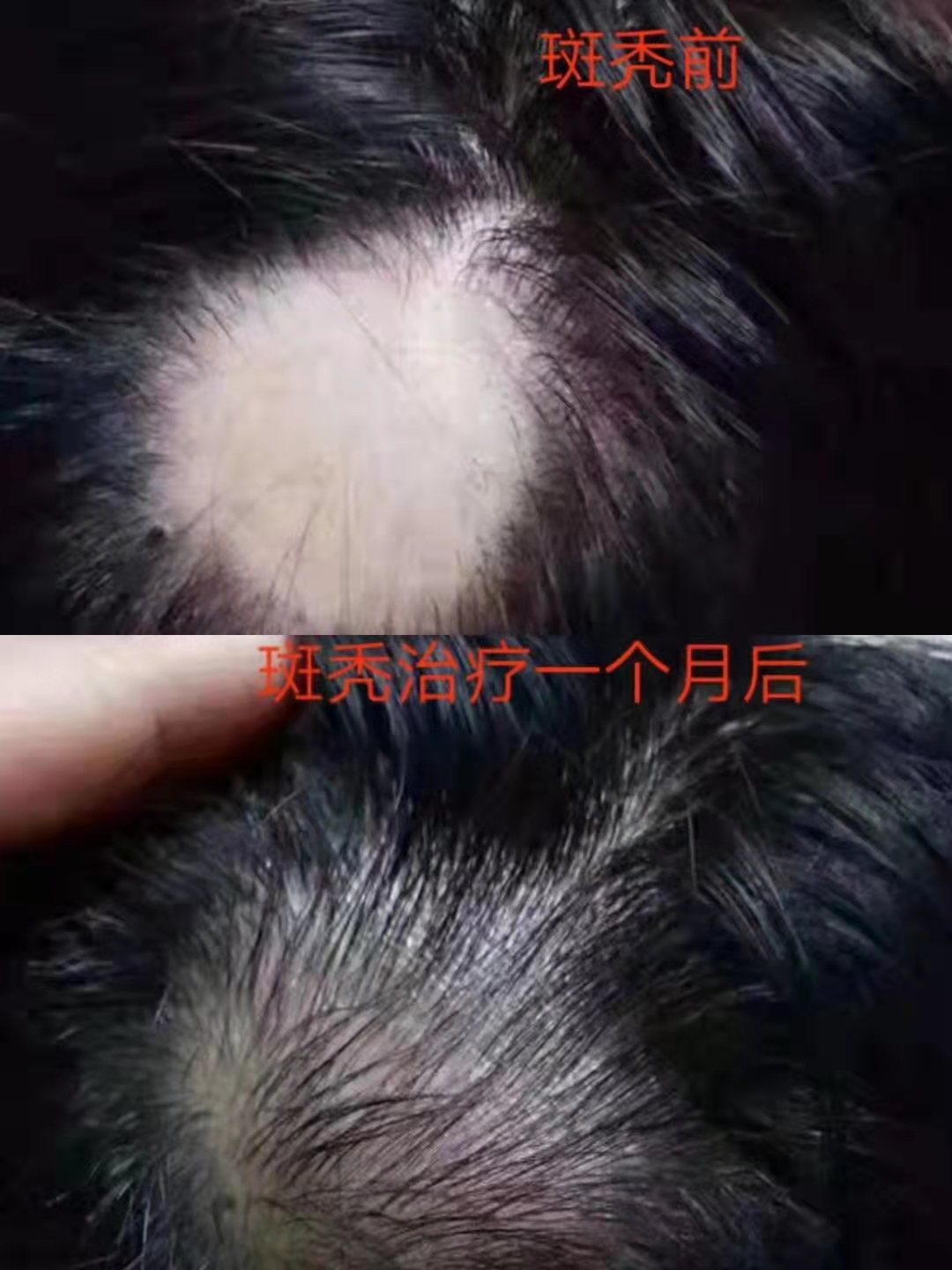 秀丝顿养发头疗坚持做对头部进行按摩,可使督脉、肝颈,胆经等循行于头部的经络气血通畅