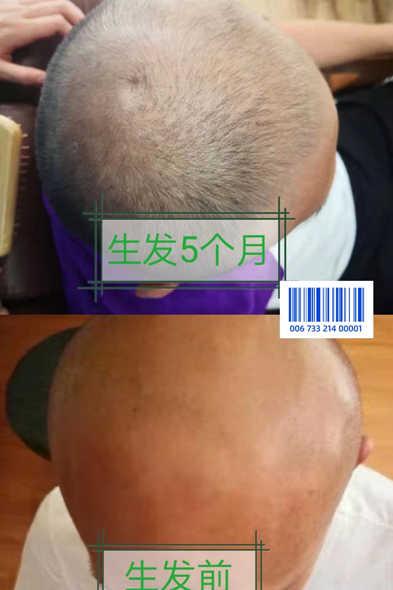 ˿ֲݵҩƼ˶ȻֲȡܹͷƤ̼ë