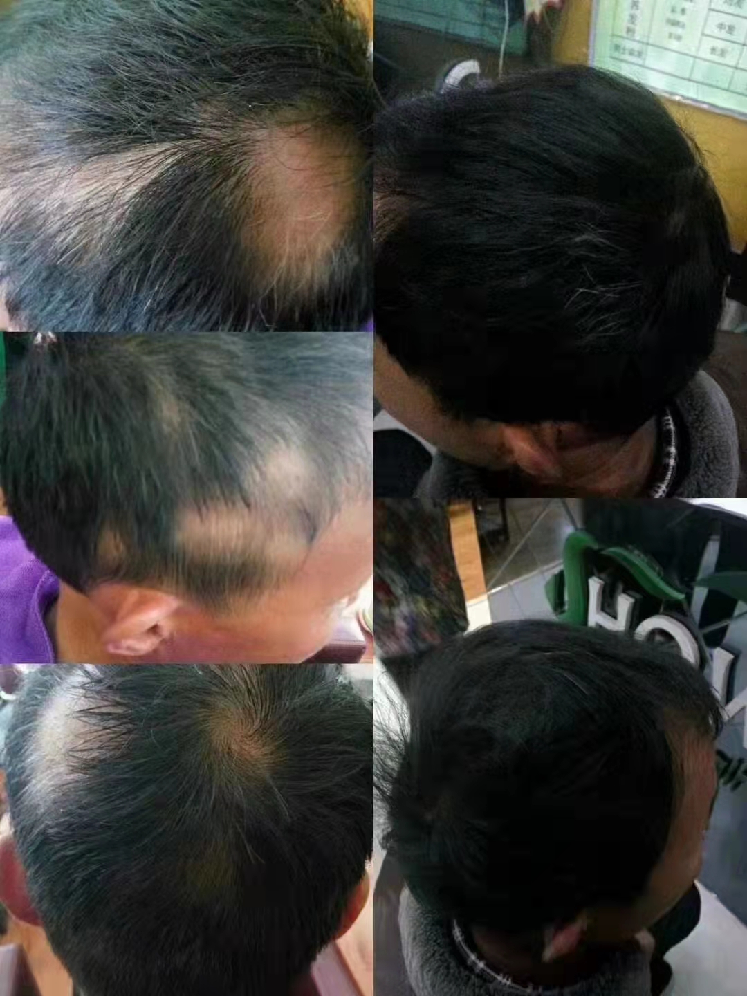 ˿ֲȻֲɷ֣ͨѧȣͷƤë