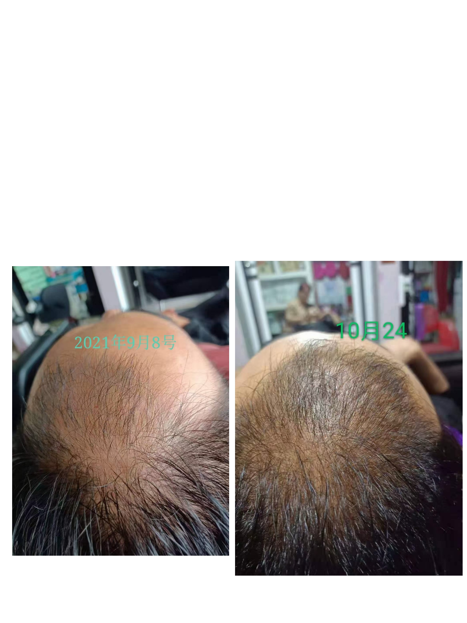 ˿ֲѷԭͨȻֲȡͲݱͷƤٽͷ
