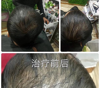 ��˿��ֲ�������ݷ��������׷�����