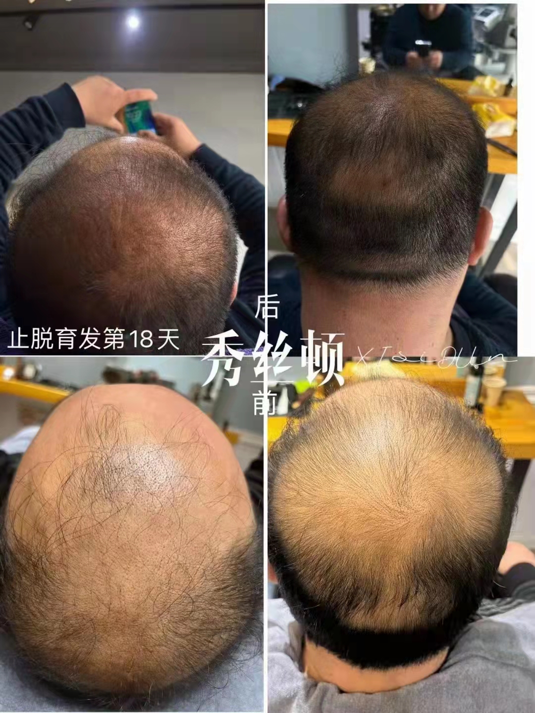 ��˿��ֲ����������ʱ�У������ṩ��һ�ָ�����������Ȼ��ͷ��Ⱦ������