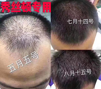 ��˿��ֲ���������������ܹ��޻�ͷ�������ˣ���ͷ��������˳���й���