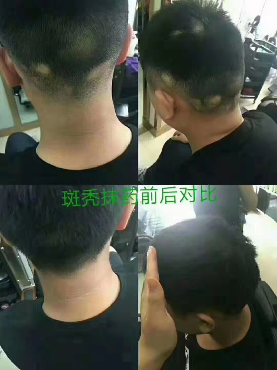 ��˿��ֲ�������ݵ���ҩ�Ƽ������˶�����Ȼֲ����ȡ����ư׷�����ֹ�ѷ�