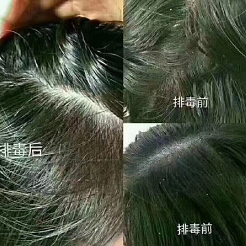 ��˿��ֲ�������������ܹ�����ͷƤ���ٽ�ͷ�����������ܹ���Ч�ؽ��׷�����