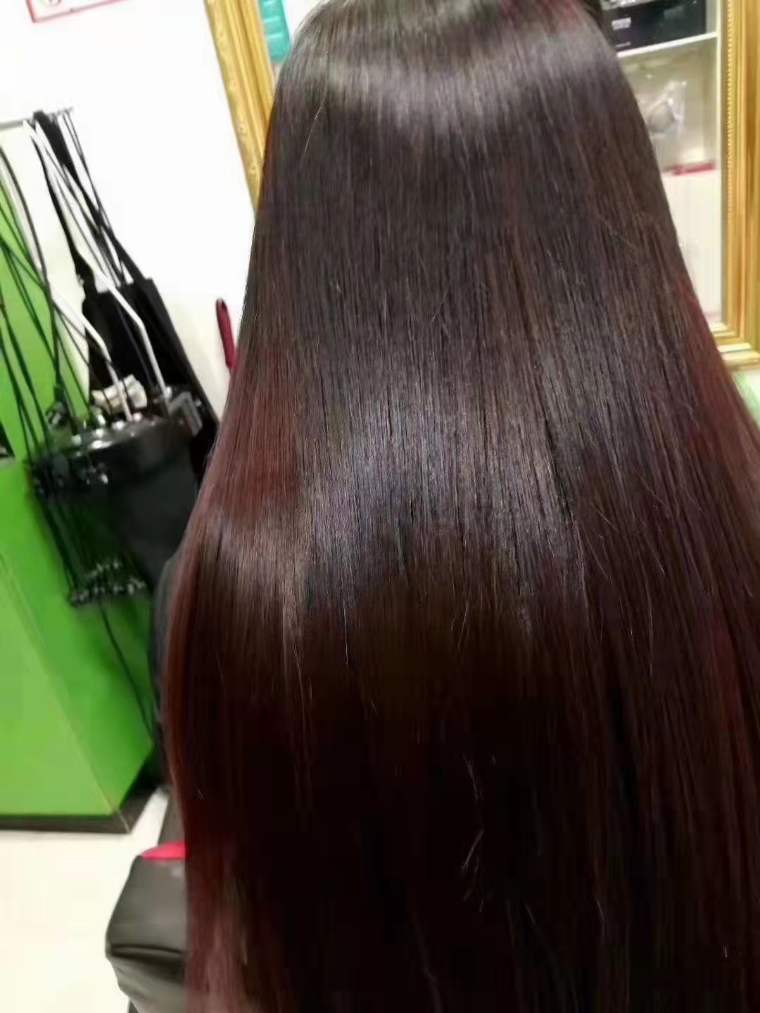 ��˿��ͷ��Ӧ�ô�ͳ��ҽ�ַ���ͨ���磬���𣬰�Ħ������һ�±�������