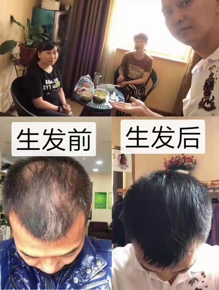 ��˿������ͷ�ƿ��Է������飬�����˵���������״̬