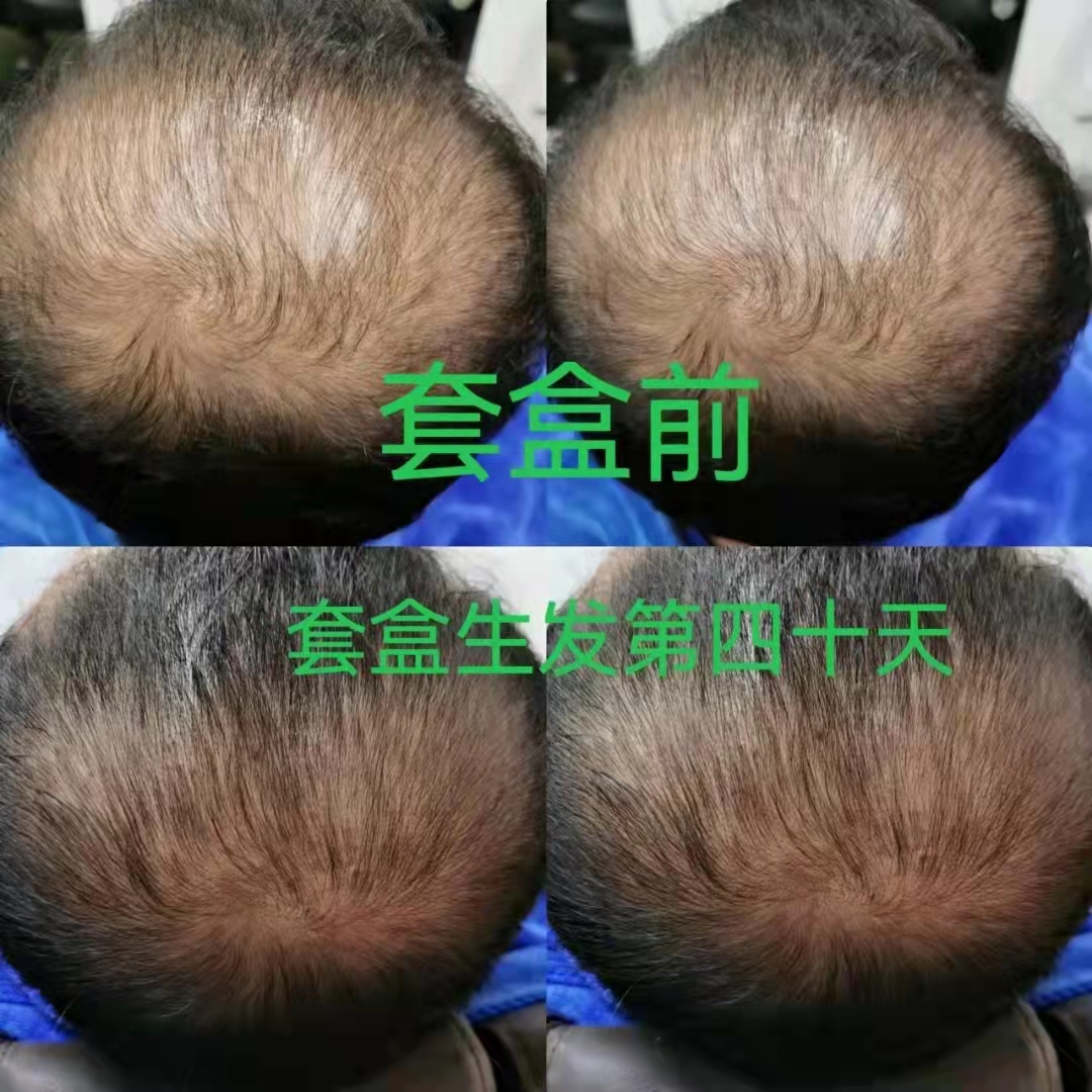��˿������ͷ���ǹ�����ҵ��ˣ�ѡ����˿��ֲ������ͷ��������õ�ѡ��