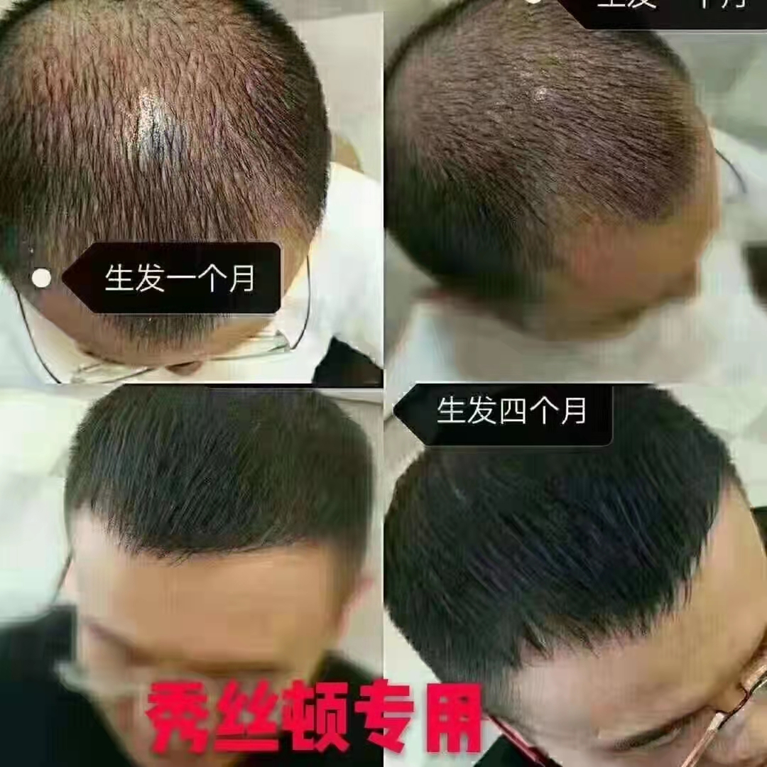 ��˿��ֲ���������������ܹ��޻�ͷ�������ˣ���ͷ��������˳���й���