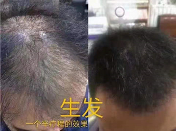 ��˿��ֲ��Ⱦ�����ô���Ȼֲ��ɷ֣��������κλ�ѧ���Ӽ�����ͷ�����˺�