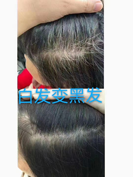 ����˿��ֲ��������һ�ַǳ���ɫ��������Ʒ�����ܹ���Ч�ؽ����İ׷����⣬