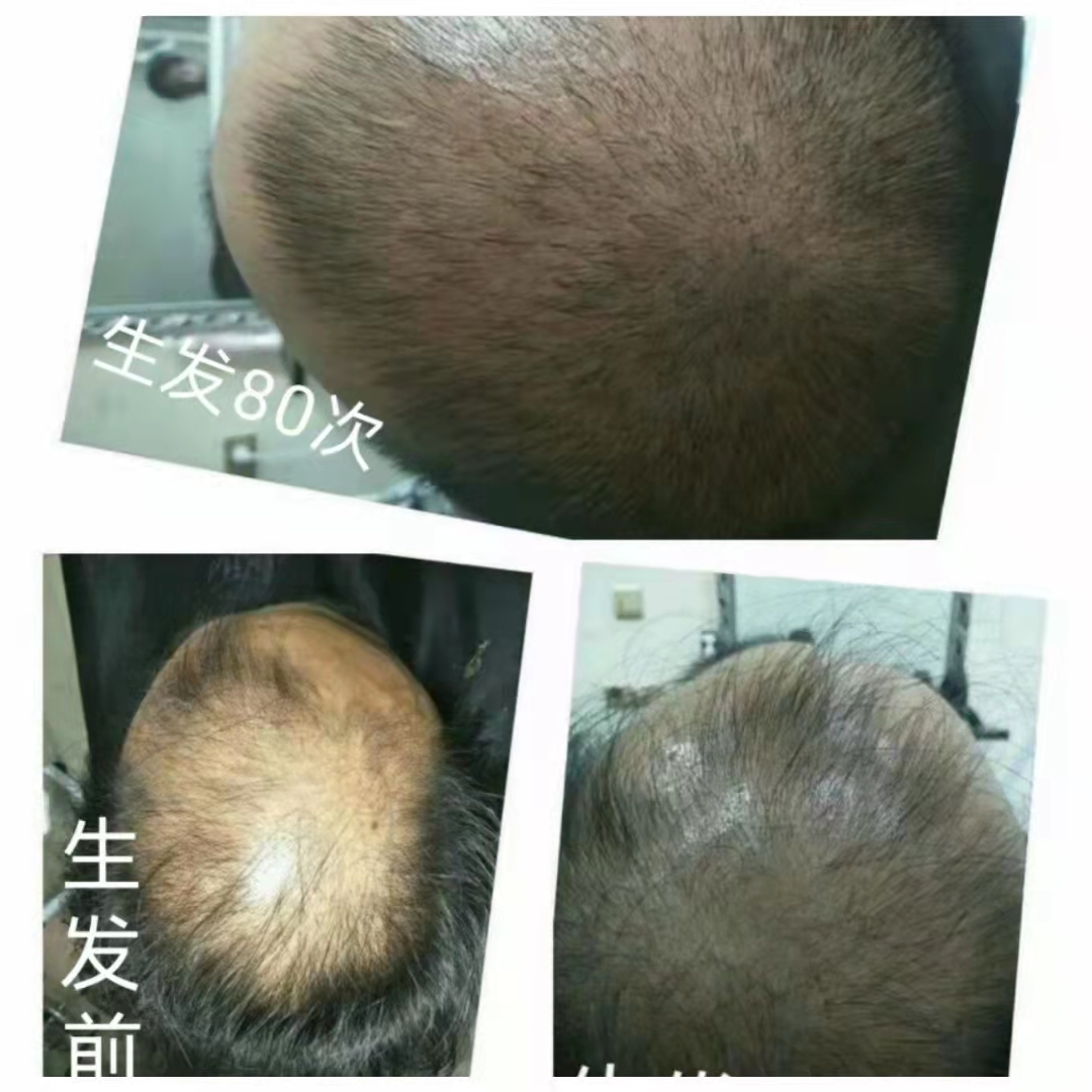 ��˿�ٴ�ֲ��������Ʒ����Ч������ͷƤ��ͷ��������ķ��ʸ��ӽ�������˳��