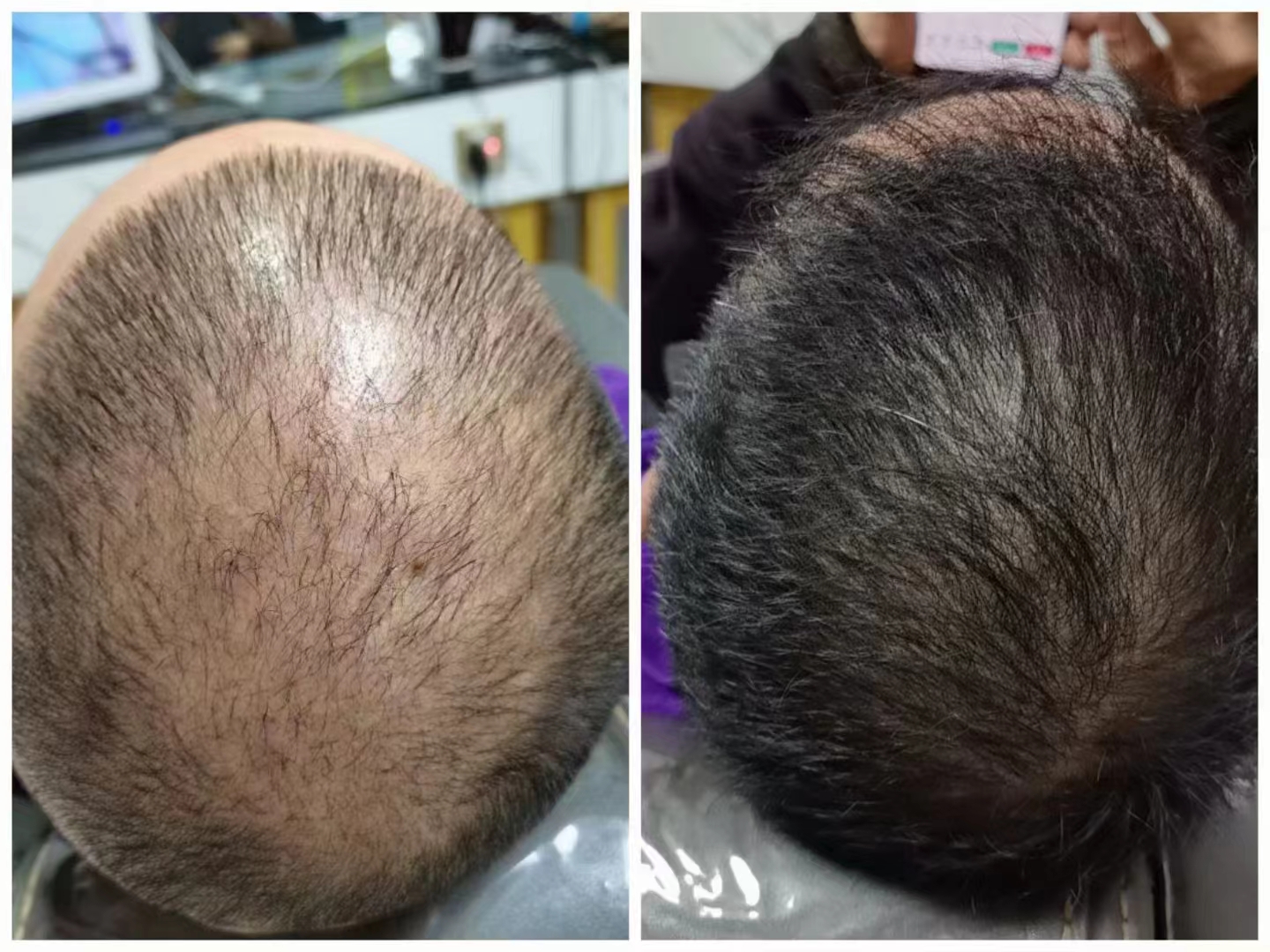 ��˿�ٰ׷����ڡ���һ�ְ�ȫ����Ч�ĸ��ư׷��İ취��