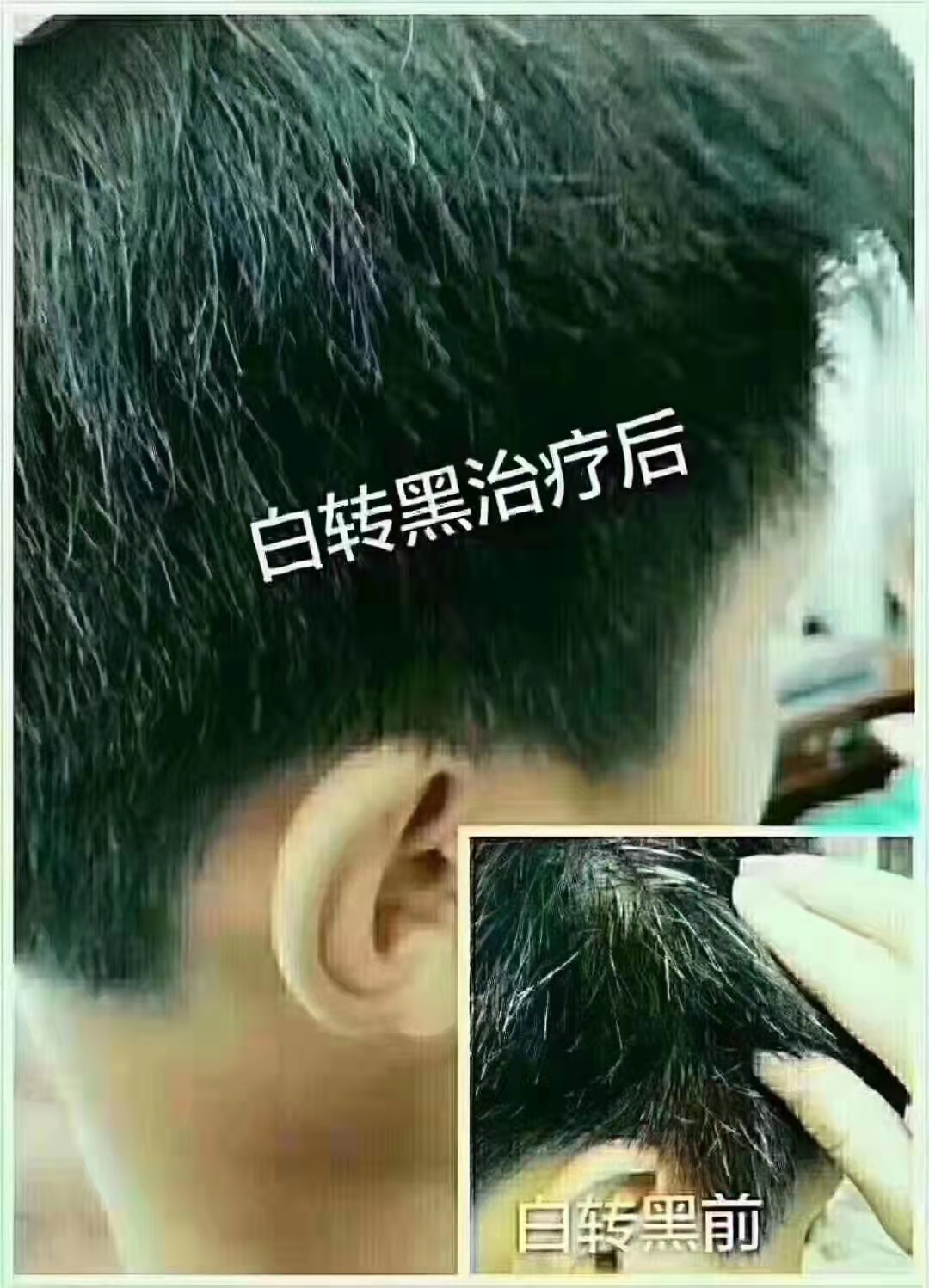 ��˿����ҩͷ�Ƹ���ͷ�ʹ�ͷ�����ѷ����ڷ��ȹ�Ч��