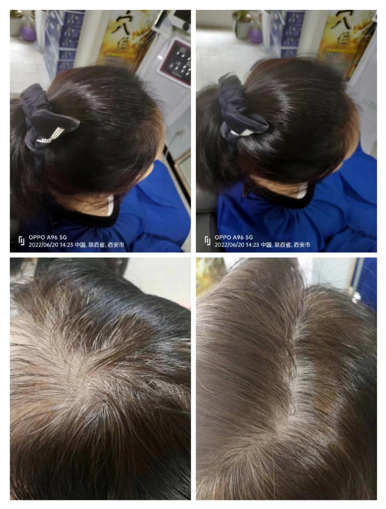 ��˿��ֲ���������������ܹ��޻�ͷ�������ˣ���ͷ��������˳���й���