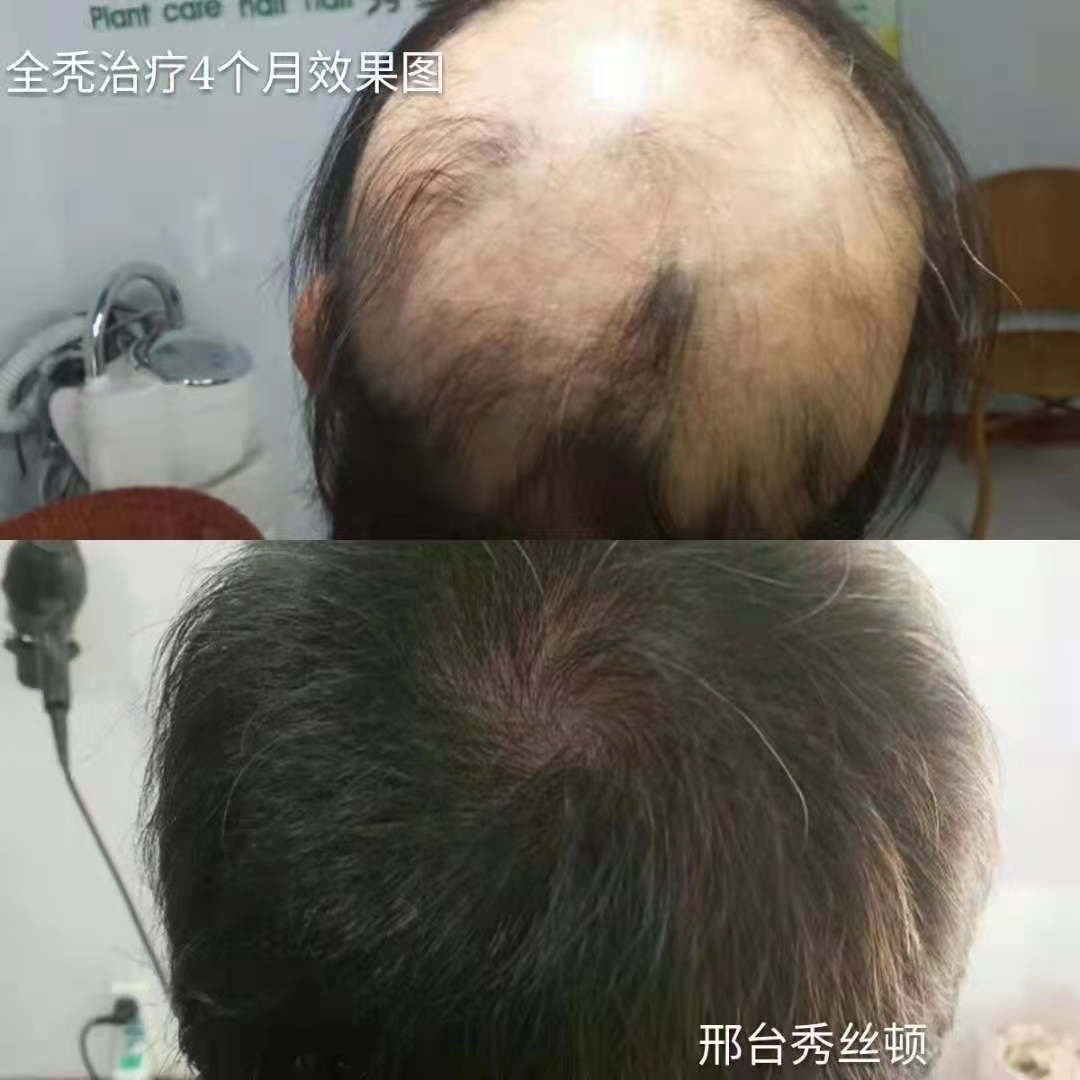 ��˿��ֲ��Ⱦ����һ��ȫ�µ�Ⱦ����ʽ����ʹ����Ȼ��ֲ�������Ⱦ����