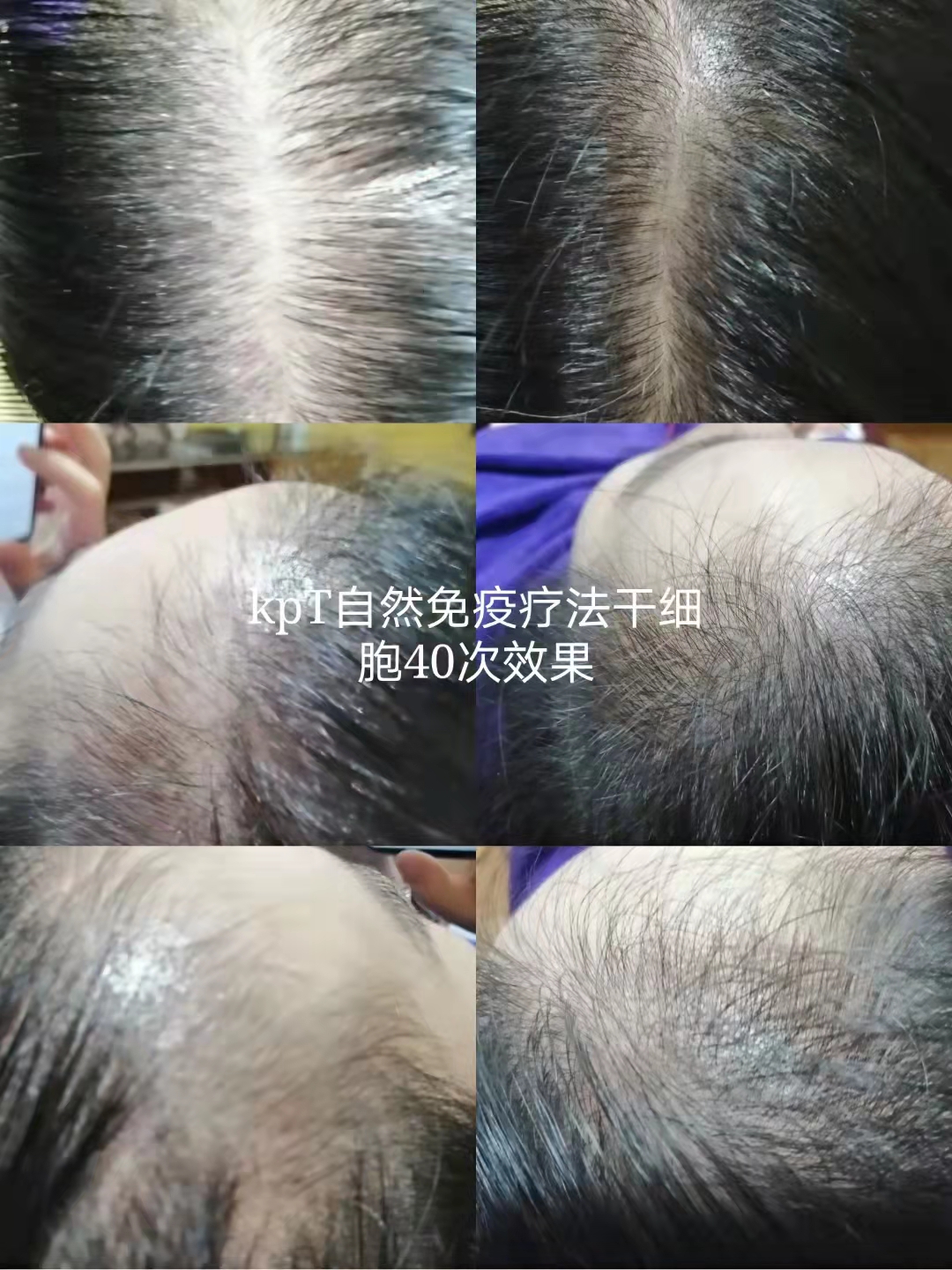 ��˿��ͷ��Ԥ���ѷ�����ͷ��������