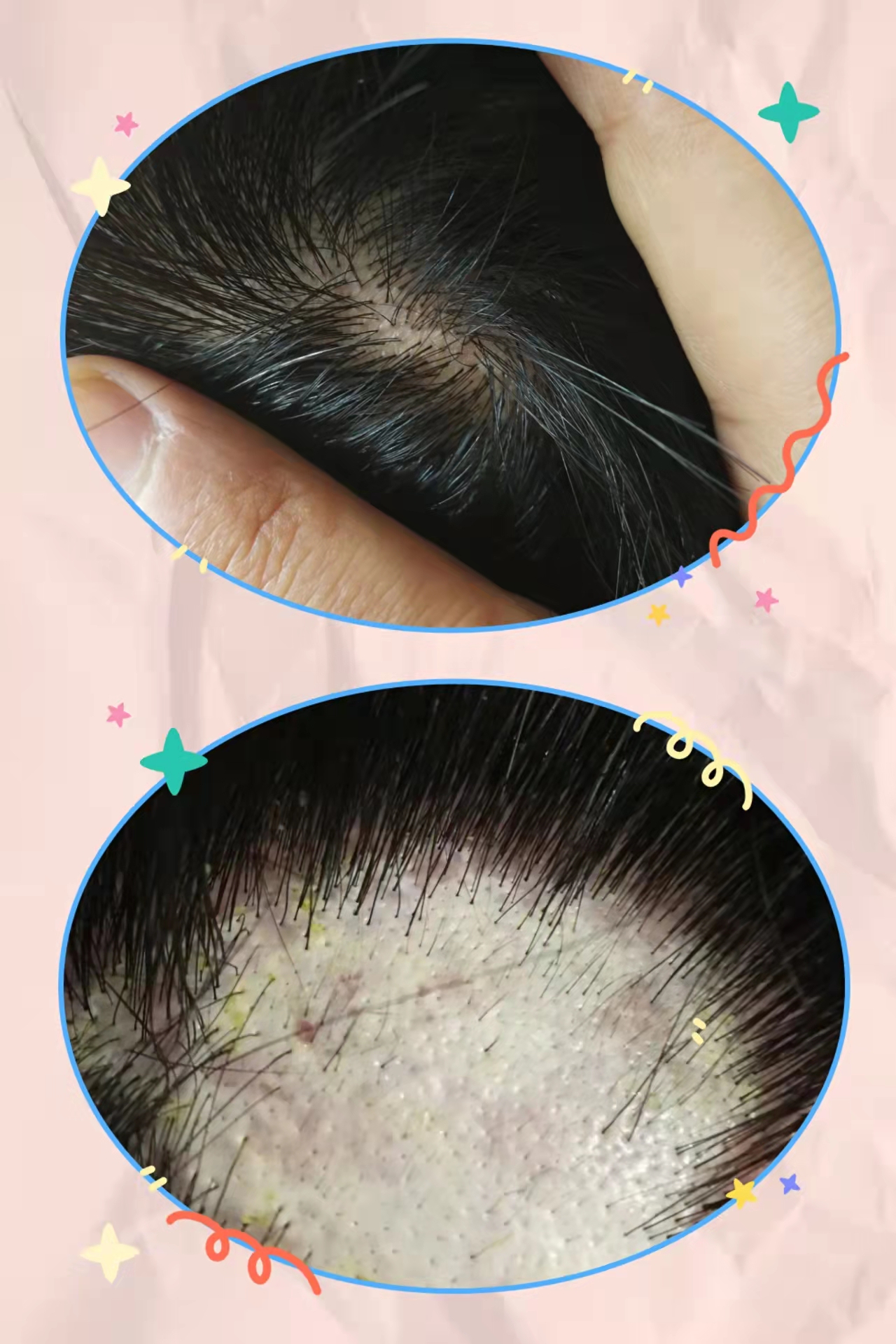 ��˿�ٰ׷����ڡ���һ�ְ�ȫ����Ч�ĸ��ư׷��İ취