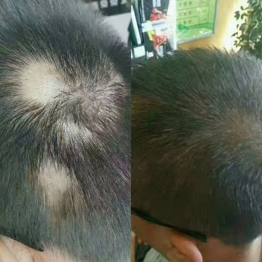 ��˿�ٺ��ȷۣ���ֲ�ﰲȫ�䷽��ȫ��ͨ��
