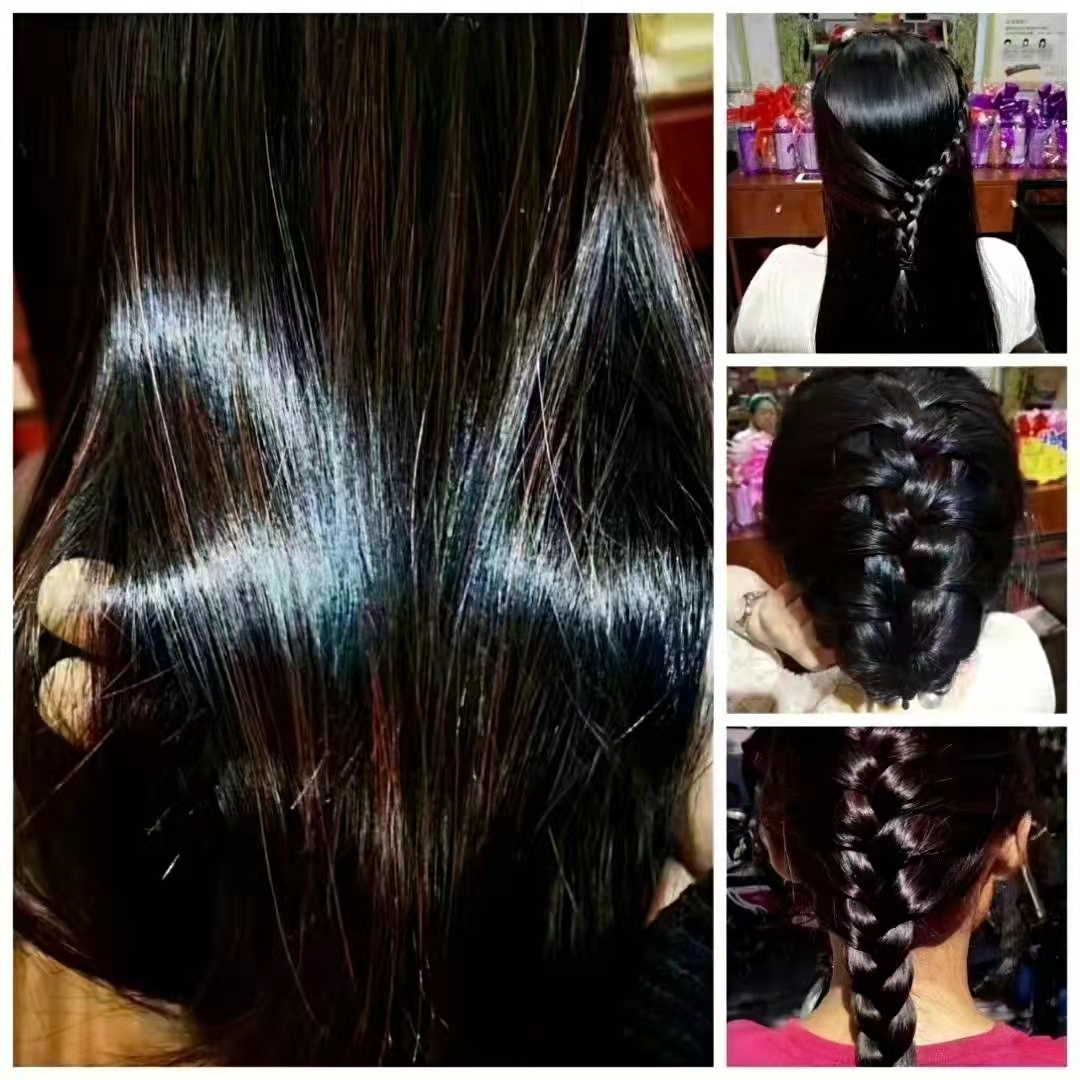 ��˿��������ͷ�Ʋ��ô�ͳ�ַ�����ѧλ��Ħ�����ƣ�����ȸ���˯��������Ԥ���ѷ����׷�