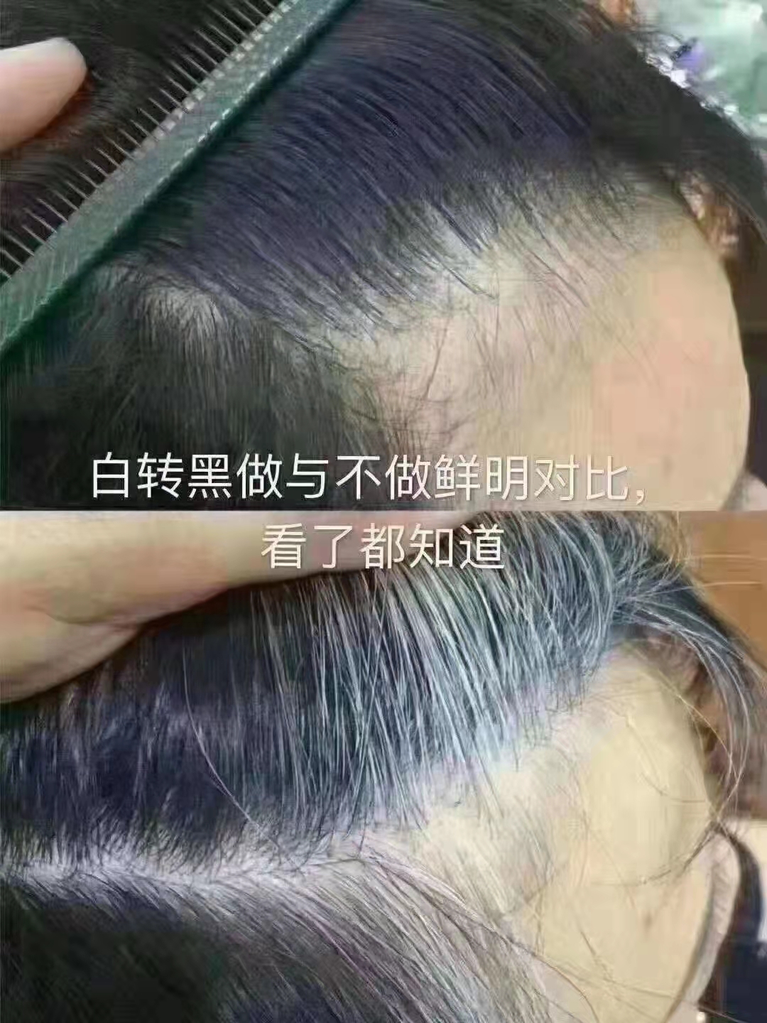 ��˿�ٺ��ȷۣ���ֲ���޴̼������м���ѡ