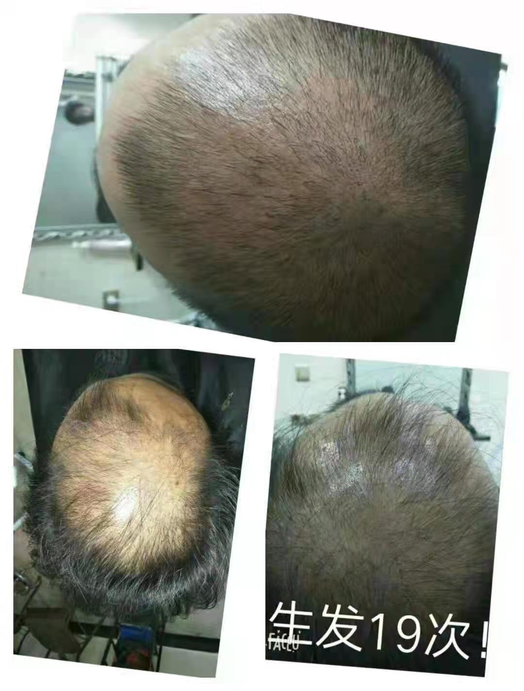 ��˿��ֲ������ͷ�ơ���˿������ͷ�����й�ֲ������ͷ����ҵ��������һָ��